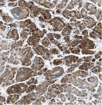 ACSL1 Rabbit Polyclonal Antibody