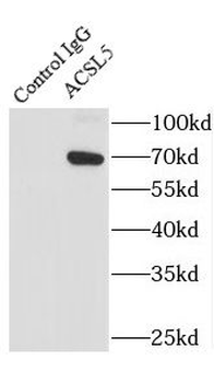 ACSL5 Antibody