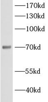 ACSL5 Rabbit Polyclonal Antibody