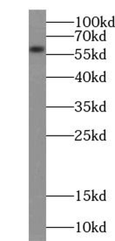 ACSM3 Rabbit Polyclonal Antibody