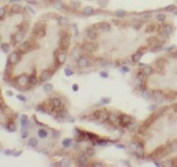 ACSM3 Rabbit Polyclonal Antibody
