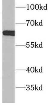 ACSM5 Rabbit Polyclonal Antibody