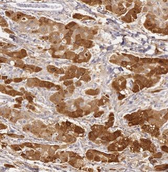 ACSM5 Rabbit Polyclonal Antibody