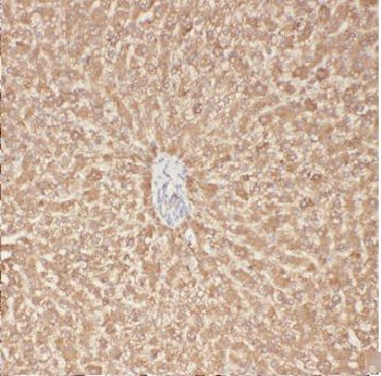 ACSS3 Rabbit Polyclonal Antibody