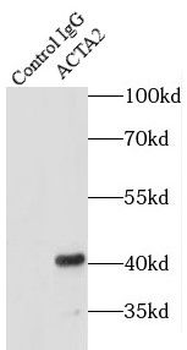 ACTA2 Antibody