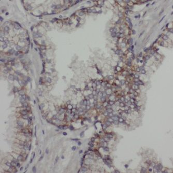 ACTL7B Rabbit Polyclonal Antibody