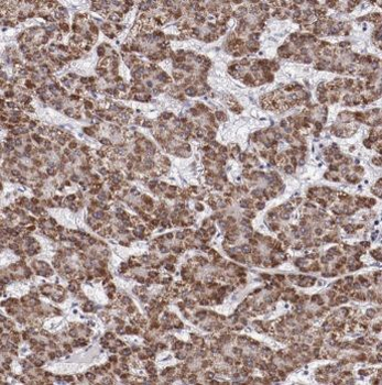 ACTR10 Rabbit Polyclonal Antibody