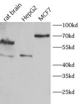 ACVR1B Rabbit Polyclonal Antibody