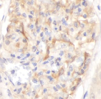 ACVR1B Rabbit Polyclonal Antibody