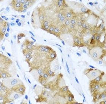 ACVR1C Rabbit Polyclonal Antibody
