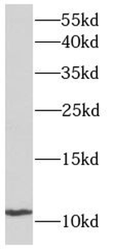 ACYP2 Rabbit Polyclonal Antibody