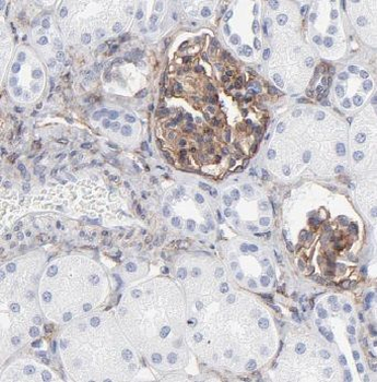 ACYP2 Rabbit Polyclonal Antibody