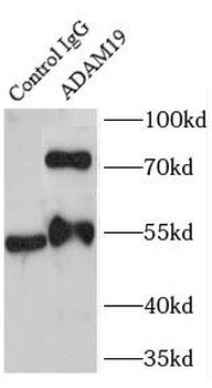 ADAM19 Rabbit Polyclonal Antibody