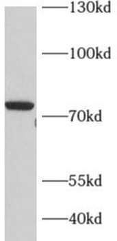 ADARB1 Antibody