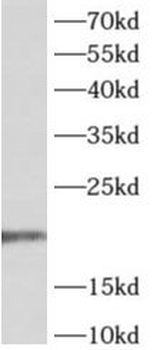 ADAT2 Antibody