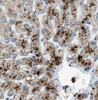 ADAT2 Rabbit Polyclonal Antibody