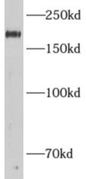 ADCY3 Antibody