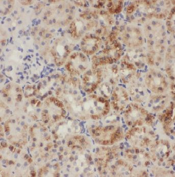 ADCY3 Rabbit Polyclonal Antibody