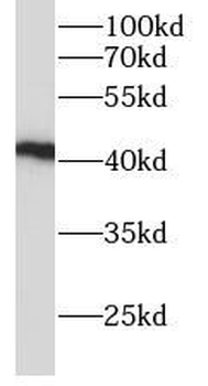 ADH4 Rabbit Polyclonal Antibody