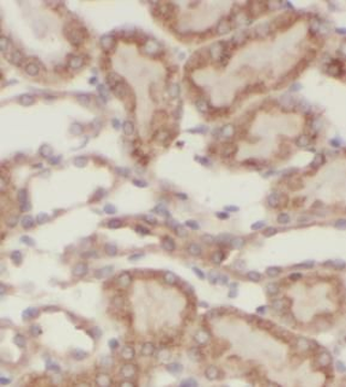 ADH4 Rabbit Polyclonal Antibody