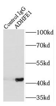 ADHFE1 Antibody