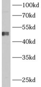 ADHFE1 Rabbit Polyclonal Antibody