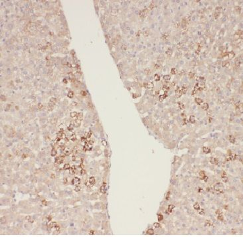 ADHFE1 Rabbit Polyclonal Antibody