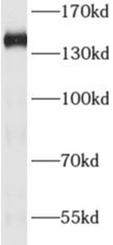 ADNP Antibody