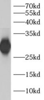 ADO Antibody