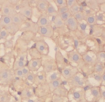 ADPGK Rabbit Polyclonal Antibody