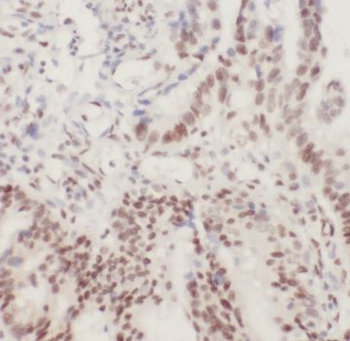 ADRM1 Rabbit Polyclonal Antibody
