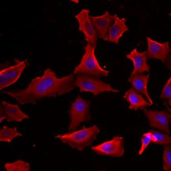 ADSS2 Antibody
