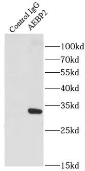 AEBP2 Antibody