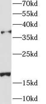 AGA Antibody