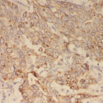 AGBL3 Rabbit Polyclonal Antibody