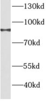 AGGF1 Antibody
