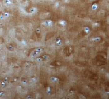 ACAN Rabbit Polyclonal Antibody
