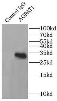 AGPAT1 Rabbit Polyclonal Antibody