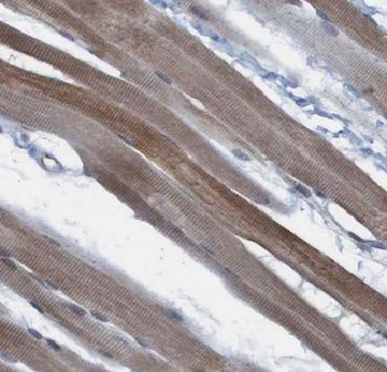 AGPAT1 Rabbit Polyclonal Antibody