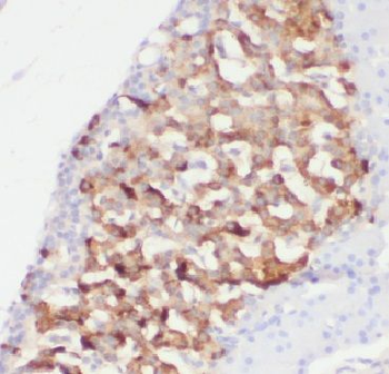 AGTRAP Antibody