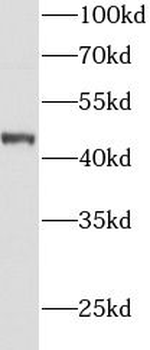 AGXT Antibody