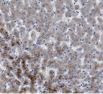 AGXT Rabbit Polyclonal Antibody