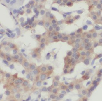 PHYKPL Antibody