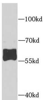 AHCYL1 Rabbit Polyclonal Antibody