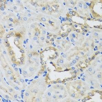 AHCYL1 Rabbit Polyclonal Antibody