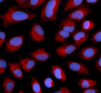 AIFM1 Antibody