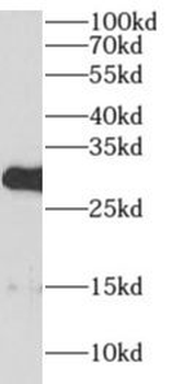 AIG1 Antibody