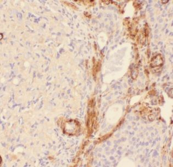 AIG1 Rabbit Polyclonal Antibody