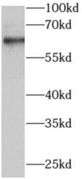 AIRE Rabbit Polyclonal Antibody
