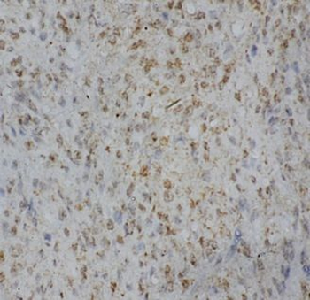 AIRE Rabbit Polyclonal Antibody